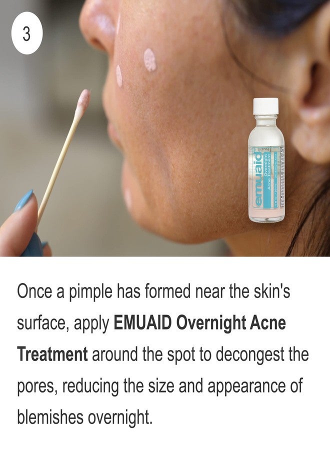 EMUAID Acne Erasing Trio - Therapeutic Moisture Bar, Overnight Acne Solution, EMUAIDMAX First Aid Ointment - Skincare Set Targets Cystic Acne, Clears Blackheads, Helps Improve Acne Scars & Blemishes - Image 5
